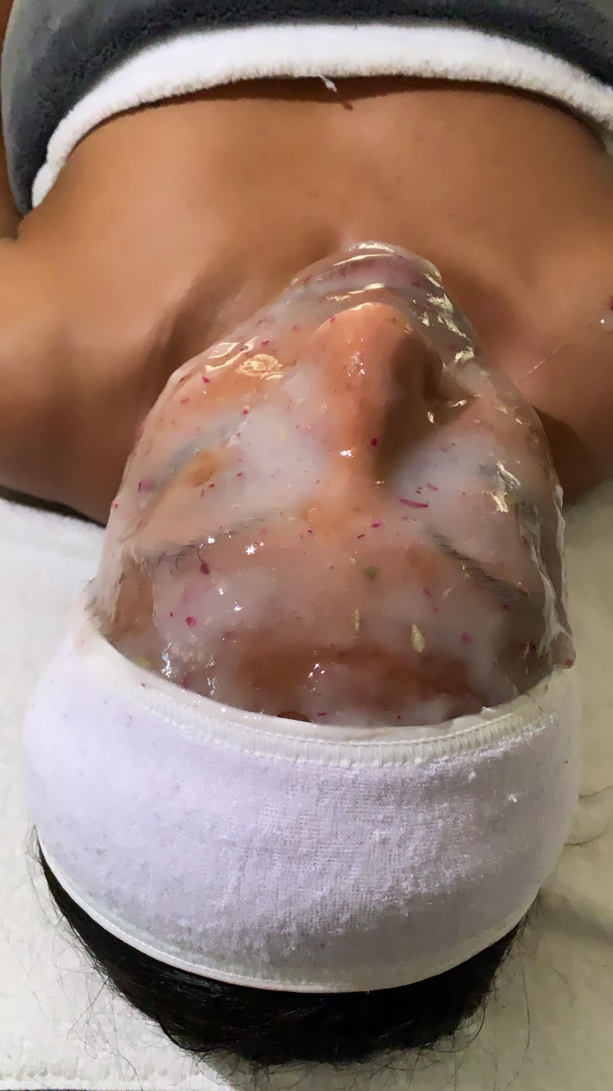 FACIAL CHEMICAL PEEL